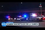 Un hombre de aproximadamente 40 años fue trasladado a la Cruz Verde Marcos Montero tras haber sido agredido con un machete en la cabeza durante la madrugada. El afectado arribó pidiendo auxilio a una tienda de conveniencia ubicada sobre la Carretera a Chapala, a unos metros del Tianguis del Automóvil, en el municipio de San Pedro #Tlaquepaque.

#NoticiasImagen

Síguenos en nuestras redes:

Instagram: https://www.instagram.com/imagentvgdl/
TikTok: https://www.tiktok.com/@imagennoticias
Twitter: https://twitter.com/ImagenTVGDL
Facebook: https://www.facebook.com/ImagenTVGDL/
Visita nuestro sitio Web: https://www.imagentv.com/guadalajara

Mantente siempre informado con las noticias sobre los acontecimientos más importantes a nivel nacional con Erick Breguer.

¡Déjanos tus comentarios, da like, comparte y suscríbete!
