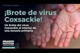 La Secretaría de Salud #Jalisco (#SSJ) confirmó la detección de un brote del virus #Coxsackie al interior de una escuela primaria ubicada en la Col. Oblatos, en #Guadalajara.

#NoticiasImagen

Síguenos en nuestras redes:

Instagram: https://www.instagram.com/imagentvgdl/
TikTok: https://www.tiktok.com/@imagennoticias
Twitter: https://twitter.com/ImagenTVGDL
Facebook: https://www.facebook.com/ImagenTVGDL/
Visita nuestro sitio Web: https://www.imagentv.com/guadalajara

Mantente siempre informado con las noticias sobre los acontecimientos más importantes a nivel nacional con Carolina Martínez.

¡Déjanos tus comentarios, da like, comparte y suscríbete!