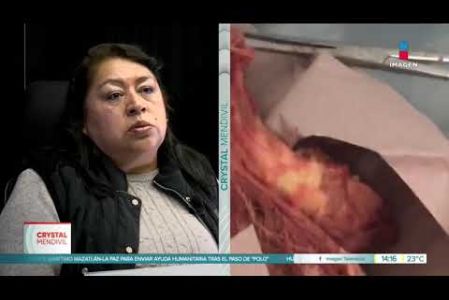 ¡8 años buscando justicia! Ella iba a un procedimiento de bajo riesgo.