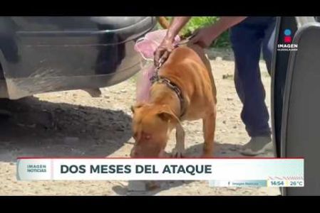 A dos meses del ataque de Canelo, un pitbull que agredió a María Guadalupe, de 67 años, la mujer continúa hospitalizada. Ha sido sometida a cerca de 10 cirugías y su familia asegura que no ha recibido apoyo del dueño. Síguenos en nuestras redes:

Instagram: https://www.instagram.com/imagentvgdl/
TikTok: https://www.tiktok.com/@imagennoticias
Twitter: https://twitter.com/ImagenTVGDL
Facebook: https://www.facebook.com/ImagenTVGDL/
Visita nuestro sitio Web: https://www.imagentv.com/guadalajara

Mantente siempre informado con las noticias sobre los acontecimientos más importantes a nivel nacional con Carolina Martínez.

¡Déjanos tus comentarios, da like, comparte y suscríbete!