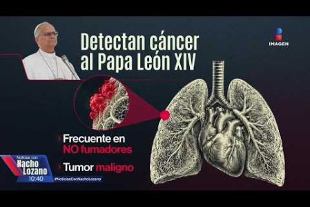 “El que lo hayan podido operar sin quimioterapia previa, nos habla de que es muy probable de que lo hayan detectado en una etapa temprana”, dijo el doctor José Manuel Mier, sobre la salud del papa León XIV. 

#NoticiasConNachoLozano
#NoticiasImagen 

¡Como nadie en la noche! #ImagenNoticias con Nacho Lozano de lunes a viernes a las 10:30 pm en el 3.1 #ImagenTelevisión. 

Visita nuestro sitio Web: http://bit.ly/2nT2Wz5 

Síguenos en nuestras redes: 
Instagram: @imagentvnoticias 
Tiktok: @imagennoticias 
X: @ImagenNoticias_ 
Facebook: https://www.facebook.com/ImagenTVNoticias/ 

Aquí encontrarás la mejor información nacional e internacional de Imagen Noticias con Francisco Zea, Paola Rojas, Crystal Mendivil y Nacho Lozano.