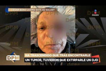 César Bono pierde su ojo tras el hallazgo de un tumor desgarrador que obligó a los médicos a realizar una cirugía de máxima urgencia, filtrándose impactantes fotografías desde el hospital que muestran las secuelas del procedimiento y el delicado estado de salud que atraviesa el querido comediante.

#DePrimeraManoTV
No te pierdas lo mejor del espectáculo de lunes a viernes De Primera Mano a las 3 p.m. con Gustavo Adolfo Infante, Addis Tuñón, Érika González y Lalo Carrillo por Imagen Televisión.

Visita también nuestra página: www.imagentv.com

▶️Programas completos: https://www.youtube.com/playlist?list=PLYnzMSw5fD7QoZlVNdIIdKqNpah_LS1R0
▶️Recopilación Especiales: https://www.youtube.com/playlist?list=PLYnzMSw5fD7RNZbEDMZ5q0349p-yeUEqm
▶️ Invitados De Primera Mano: https://www.youtube.com/playlist?list=PLYnzMSw5fD7QR3p02rRedi-ZorW3R2NZy

Síguenos en:
TikTok: https://www.tiktok.com/@deprimeramanoitv
Instagram: https://www.instagram.com/deprimeramanoitv/
Facebook: https://www.facebook.com/DePrimeraManoImagenTV
X: https://twitter.com/deprimeramano


O en las redes de Imagen Televisión
Facebook: https://www.facebook.com/ImagenTVMex
Twitter: https://twitter.com/ImagenTVMex
Instagram: https://www.instagram.com/imagentvmex/
TikTok: https://www.tiktok.com/@imagentv