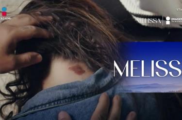 E 67 Melissa | Mi hija.