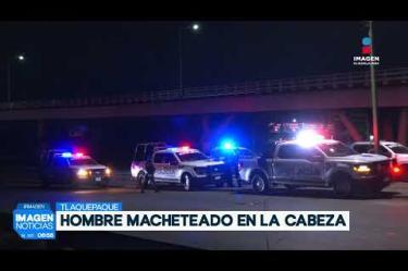 Un hombre de aproximadamente 40 años fue trasladado a la Cruz Verde Marcos Montero tras haber sido agredido con un machete en la cabeza durante la madrugada. El afectado arribó pidiendo auxilio a una tienda de conveniencia ubicada sobre la Carretera a Chapala, a unos metros del Tianguis del Automóvil, en el municipio de San Pedro #Tlaquepaque.
#NoticiasImagen
Síguenos en nuestras redes:
Instagram: https://www.instagram.com/imagentvgdl/
TikTok: https://www.tiktok.com/@imagennoticias
Twitter: https://twitter.com/ImagenTVGDL
Facebook: https://www.facebook.com/ImagenTVGDL/
Visita nuestro sitio Web: https://www.imagentv.com/guadalajara
Mantente siempre informado con las noticias sobre los acontecimientos más importantes a nivel nacional con Erick Breguer.
¡Déjanos tus comentarios, da like, comparte y suscríbete!