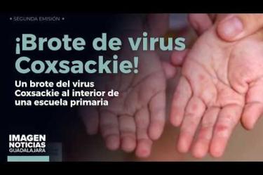 La Secretaría de Salud #Jalisco (#SSJ) confirmó la detección de un brote del virus #Coxsackie al interior de una escuela primaria ubicada en la Col. Oblatos, en #Guadalajara.
#NoticiasImagen
Síguenos en nuestras redes:
Instagram: https://www.instagram.com/imagentvgdl/
TikTok: https://www.tiktok.com/@imagennoticias
Twitter: https://twitter.com/ImagenTVGDL
Facebook: https://www.facebook.com/ImagenTVGDL/
Visita nuestro sitio Web: https://www.imagentv.com/guadalajara
Mantente siempre informado con las noticias sobre los acontecimientos más importantes a nivel nacional con Carolina Martínez.
¡Déjanos tus comentarios, da like, comparte y suscríbete!