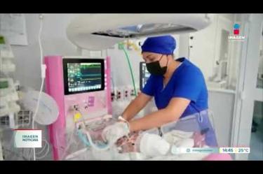 Especialistas del #IMSS analizan el deceso de recién nacidos por la bacteria #Klebsiella en la Unidad de Cuidados Intensivos Neonatales del Hospital de Gineco Obstetricia del Centro Médico Nacional de Occidente, en #Guadalajara.
#NoticiasImagen
Síguenos en nuestras redes:
Instagram: https://www.instagram.com/imagentvgdl/
TikTok: https://www.tiktok.com/@imagennoticias
Twitter: https://twitter.com/ImagenTVGDL
Facebook: https://www.facebook.com/ImagenTVGDL/
Visita nuestro sitio Web: https://www.imagentv.com/guadalajara
Mantente siempre informado con las noticias sobre los acontecimientos más importantes a nivel nacional con Carolina Martínez.
¡Déjanos tus comentarios, da like, comparte y suscríbete!