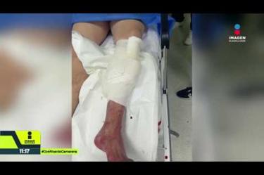 Un hombre de 50 años fue baleado en la rodilla izquierda tras pedir que no se estacionaran afuera de su casa, en la colonia López Portillo de Guadalajara. Fue trasladado a la Cruz Verde de Zapopan.