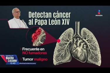 “El que lo hayan podido operar sin quimioterapia previa, nos habla de que es muy probable de que lo hayan detectado en una etapa temprana”, dijo el doctor José Manuel Mier, sobre la salud del papa León XIV.
#NoticiasConNachoLozano
#NoticiasImagen
¡Como nadie en la noche! #ImagenNoticias con Nacho Lozano de lunes a viernes a las 10:30 pm en el 3.1 #ImagenTelevisión.
Visita nuestro sitio Web: http://bit.ly/2nT2Wz5
Síguenos en nuestras redes:
Instagram: @imagentvnoticias
Tiktok: @imagennoticias
X: @ImagenNoticias_
Facebook: https://www.facebook.com/ImagenTVNoticias/
Aquí encontrarás la mejor información nacional e internacional de Imagen Noticias con Francisco Zea, Paola Rojas, Crystal Mendivil y Nacho Lozano.