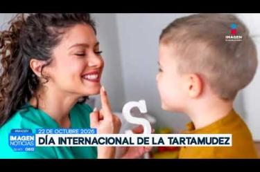 En el marco del Día Internacional de la Concientización sobre la Tartamudez este 22 de octubre, especialistas destacan la importancia de visibilizar este trastorno de la fluidez del habla que afecta a entre el 1% y el 3% de la población adulta en México.
#NoticiasImagen
Síguenos en nuestras redes:
Instagram: https://www.instagram.com/imagentvgdl/
TikTok: https://www.tiktok.com/@imagennoticias
Twitter: https://twitter.com/ImagenTVGDL
Facebook: https://www.facebook.com/ImagenTVGDL/
Visita nuestro sitio Web: https://www.imagentv.com/guadalajara
Mantente siempre informado con las noticias sobre los acontecimientos más importantes a nivel nacional con Erick Breguer.
¡Déjanos tus comentarios, da like, comparte y suscríbete!